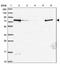 Zinc Finger CCCH-Type Containing 14 antibody, PA5-62050, Invitrogen Antibodies, Western Blot image 