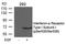 Interferon Alpha And Beta Receptor Subunit 1 antibody, PA5-37789, Invitrogen Antibodies, Western Blot image 