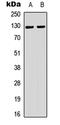 Telomerase Reverse Transcriptase antibody, LS-C368547, Lifespan Biosciences, Western Blot image 