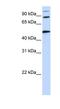 Component Of Oligomeric Golgi Complex 4 antibody, NBP1-55199, Novus Biologicals, Western Blot image 