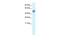 SAP30 Binding Protein antibody, PA5-40862, Invitrogen Antibodies, Western Blot image 