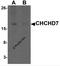 Coiled-Coil-Helix-Coiled-Coil-Helix Domain Containing 7 antibody, 7143, ProSci, Western Blot image 