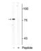 Solute Carrier Family 6 Member 4 antibody, NBP2-60778, Novus Biologicals, Western Blot image 
