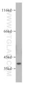 Dual Specificity Phosphatase 11 antibody, 10204-2-AP, Proteintech Group, Western Blot image 