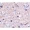 Programmed Cell Death 1 antibody, NBP1-75519, Novus Biologicals, Immunohistochemistry frozen image 