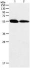 Kruppel Like Factor 5 antibody, orb107539, Biorbyt, Western Blot image 