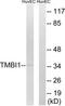 Transmembrane BAX Inhibitor Motif Containing 1 antibody, TA315717, Origene, Western Blot image 