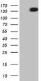 Platelet Derived Growth Factor Receptor Alpha antibody, LS-C791334, Lifespan Biosciences, Western Blot image 