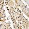 Transcription Factor Dp-1 antibody, LS-C334054, Lifespan Biosciences, Immunohistochemistry paraffin image 