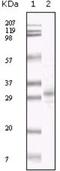 KSHV ORF26 antibody, NBP1-47357, Novus Biologicals, Western Blot image 