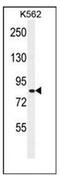 Whirlin antibody, AP51246PU-N, Origene, Western Blot image 