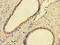 GDP-Mannose Pyrophosphorylase B antibody, LS-C380332, Lifespan Biosciences, Immunohistochemistry paraffin image 