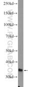 Glycine-N-Acyltransferase antibody, 10900-1-AP, Proteintech Group, Western Blot image 