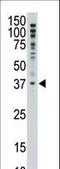 MAGE Family Member F1 antibody, LS-C100417, Lifespan Biosciences, Western Blot image 