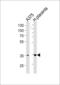 Aldose reductase antibody, PA5-12315, Invitrogen Antibodies, Western Blot image 