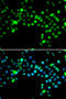 Serine And Arginine Rich Splicing Factor 4 antibody, STJ29058, St John