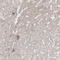 ATP Binding Cassette Subfamily C Member 11 antibody, HPA031980, Atlas Antibodies, Immunohistochemistry frozen image 