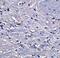 Glycerol-3-Phosphate Acyltransferase, Mitochondrial antibody, A05432, Boster Biological Technology, Immunohistochemistry paraffin image 