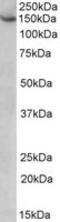 ATP/GTP Binding Protein 1 antibody, LS-C139671, Lifespan Biosciences, Western Blot image 