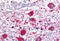 Roundabout Guidance Receptor 1 antibody, MBS240214, MyBioSource, Immunohistochemistry frozen image 