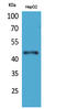 Homeobox D3 antibody, STJ96560, St John