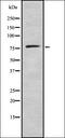 Adhesion G Protein-Coupled Receptor L4 antibody, orb378280, Biorbyt, Western Blot image 