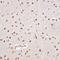 RNA Binding Motif Protein 3 antibody, GTX66019, GeneTex, Immunohistochemistry paraffin image 