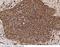 V-Set Domain Containing T Cell Activation Inhibitor 1 antibody, 10738-T24, Sino Biological, Immunohistochemistry paraffin image 