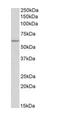 Tryptophan Hydroxylase 2 antibody, ab121013, Abcam, Western Blot image 