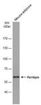 Perilipin 1 antibody, MA5-27861, Invitrogen Antibodies, Western Blot image 