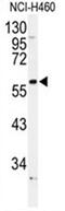 Adrenoceptor Alpha 1B antibody, AP50099PU-N, Origene, Western Blot image 