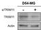 Tripartite Motif Containing 11 antibody, NB100-1214, Novus Biologicals, Western Blot image 