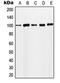 Minichromosome Maintenance Complex Component 4 antibody, orb214235, Biorbyt, Western Blot image 