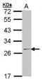 60S ribosomal protein L14 antibody, NBP1-33068, Novus Biologicals, Western Blot image 