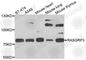 RAS Guanyl Releasing Protein 3 antibody, A7791, ABclonal Technology, Western Blot image 
