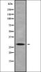 Zinc Finger CCHC-Type Containing 17 antibody, orb338518, Biorbyt, Western Blot image 
