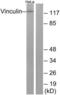 Vinculin antibody, LS-B5770, Lifespan Biosciences, Western Blot image 