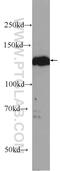 Serine/Threonine Kinase 10 antibody, 25471-1-AP, Proteintech Group, Western Blot image 