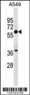 Squalene Epoxidase antibody, 56-547, ProSci, Western Blot image 