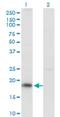 KiSS-1 Metastasis Suppressor antibody, H00003814-M03, Novus Biologicals, Western Blot image 