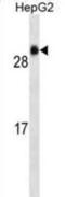 Glutathione S-transferase A1 antibody, abx025298, Abbexa, Western Blot image 