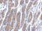 Hydroxysteroid 17-Beta Dehydrogenase 6 antibody, GTX109009, GeneTex, Immunohistochemistry paraffin image 