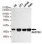 Aldose reductase antibody, M01621-2, Boster Biological Technology, Western Blot image 