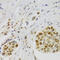 Nuclear Autoantigenic Sperm Protein antibody, 22-569, ProSci, Immunohistochemistry paraffin image 
