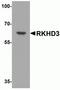Mex-3 RNA Binding Family Member B antibody, NBP2-81777, Novus Biologicals, Western Blot image 