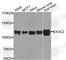 Exocyst Complex Component 2 antibody, A8235, ABclonal Technology, Western Blot image 