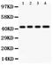 Haptoglobin antibody, PB9219, Boster Biological Technology, Western Blot image 