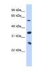 Ubiquitin Conjugating Enzyme E2 K antibody, orb330277, Biorbyt, Western Blot image 