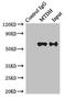 Metadherin antibody, LS-C377988, Lifespan Biosciences, Immunoprecipitation image 