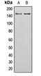 PEAK1 Related, Kinase-Activating Pseudokinase 1 antibody, orb215993, Biorbyt, Western Blot image 